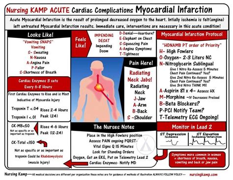 Nursingkampcom Cardiovascular Myocardial Infarction Stickenote Mnemonics Immediate