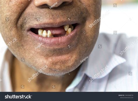 Smile Of Toothless Old Man Royalty Free Stock Photo 1043308576