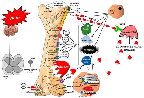 Ijms Free Full Text Bone Pain In Cancer Patients Mechanisms And