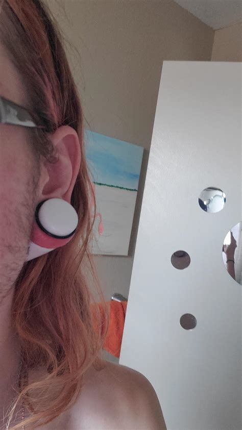 Not Sure If I Put This Here But Is My Gauged Ear Infected Or Is