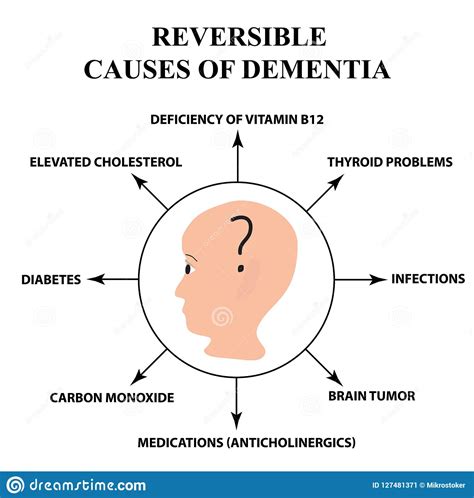 Reversible Causes of Senile Dementia. Alzheimer`s Disease. Infographics ...