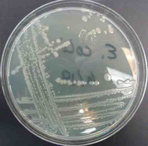 bacterial colonies streak plate  images photographs