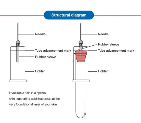 Hyaluronic acid | dermatologist explains the importance. 24mg/Ml Serum Hyaluronik Acid Dermal Fillers Cross Linked ...