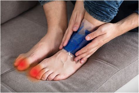 Big Toe Gout Symptoms Causes And Treatments