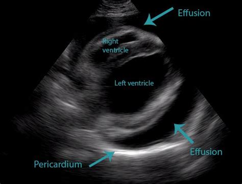 Pleural Effusion Cat Ultrasound Hang Saucedo