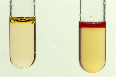 Indole Test