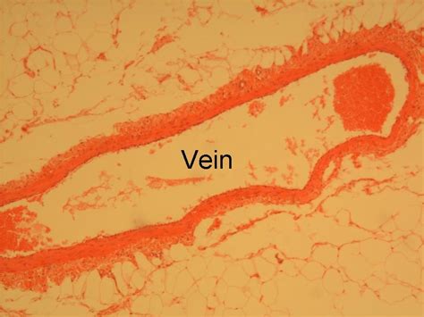 Blood vessels 2 labeled palmar arch digital artery right femoral a right femoral v great saphenous vein left popliteal a right anterior tibial a. Histology of Blood Vessels