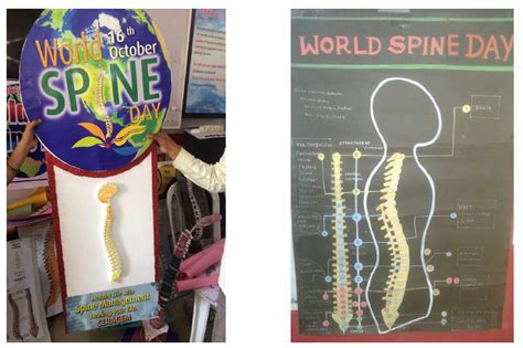 Ceragem India World Spine Day Bonanza World Spine Day