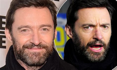 Hugh Jackman Spotted Without Nose Bandage After Having Skin Cancer Removal Daily Mail Online