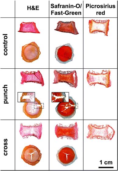 Histology Of Healthy Control Punch And Cross Incision Injury