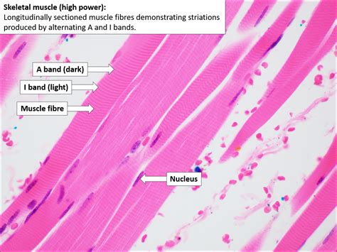 Skeletal Muscle Normal Histology Nus Pathweb Nus Pathweb