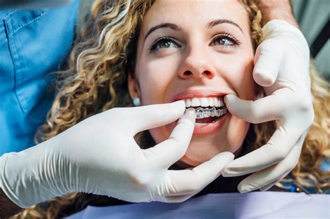 Do You Consider Invisalign A Good Option For Misaligned Teeth Services