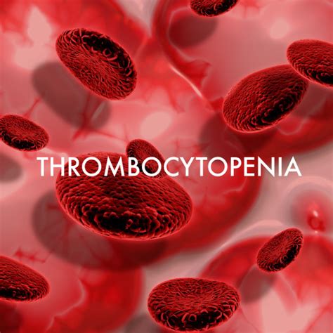 Low Platelet Count Treatment Thrombocytopenia Treatment Hocc India