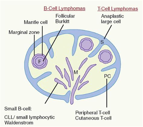 Diagnosis And Classification Of Lymphomas Oncohema Key