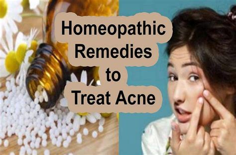 Acne Treatment In Homeopathy Homeopathic Remedies For Acne Oily Skin