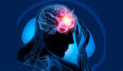Causas Efectos Y Tratamientos De La Epilepsia