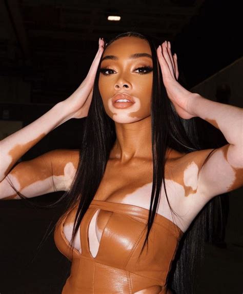 winnie harlow in a tiny bikini celebrates new year in uae 6 photos the fappening