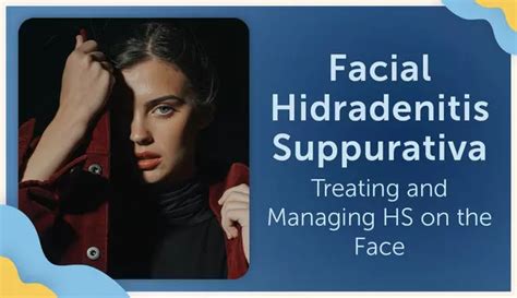 Facial Hidradenitis Suppurativa Treating And Managing Hs On The Face
