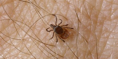 The Hidden Epidemic Of Lyme Disease Huffpost