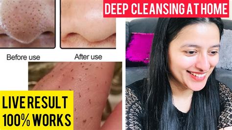 7 Days Challenge No More Blackhead Open Pores Clogged Pores Deep