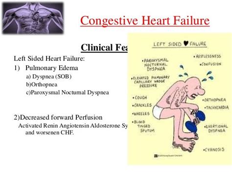 15 Congestive Heart Failure Clinical Features Left Sided