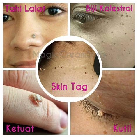 Lepas seminggu tona kulit dah nampak makin lebih sekata dan semakin cerah. Hellow Cantik..: MAGIC CREAM SOFFY : BUANG KETUAT, TAHI ...