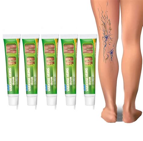 5pcs Varicose Vein Cream For Legsvaricose Vein Treatment Cream For