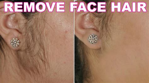 remove facial hair with these 3 ingredients in no time top 5 diy