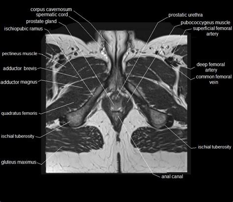 The pelvic region holds major organs under its layers of muscles. MRI pelvis anatomy | free male pelvis axial anatomy