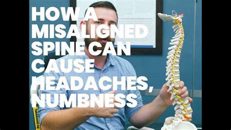 How A Misaligned Spine Can Cause Headaches Numbness And Other Pains