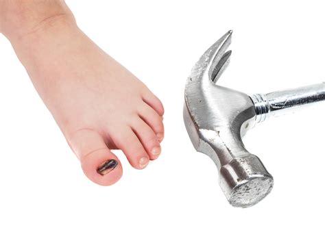 What Is Hammer Toe And How To Fix Them Marietta Foot Doctor