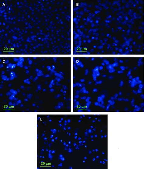 Nuclear Morphologies Of MCF 7 Cells Using Hoechst 33342 Staining Cells