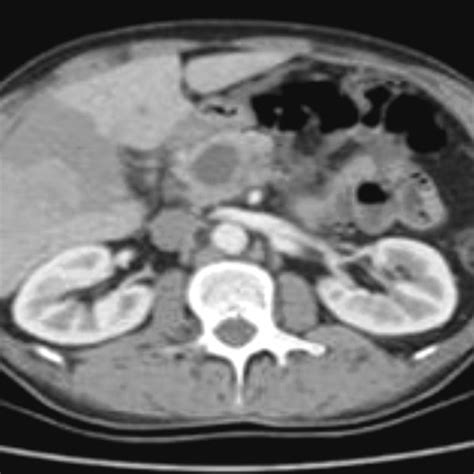Cele mai bune panouri ale utilizatorului liliana mocanu. Liliana MOCANU | Certified Board Pathologist | Certified ...