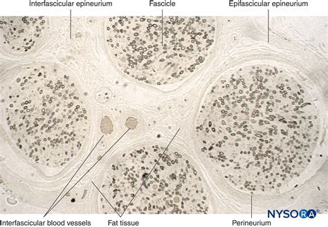 Histology Of The Peripheral Nerves And Light Microscopy Nysora