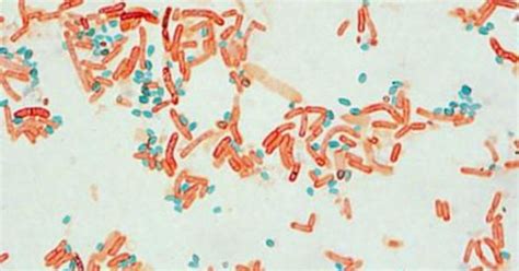 Bacillus Cereus Endospore Stain Janiyahroscopeland