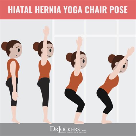 Exercises To Stop A Hiatal Hernia Hernia Symptoms Hea Vrogue Co