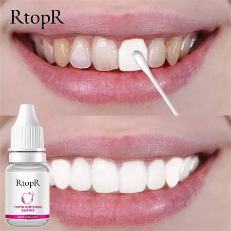 Rtopr Teeth Whitening Essence Brightens Teeth Removes Plaque Oral
