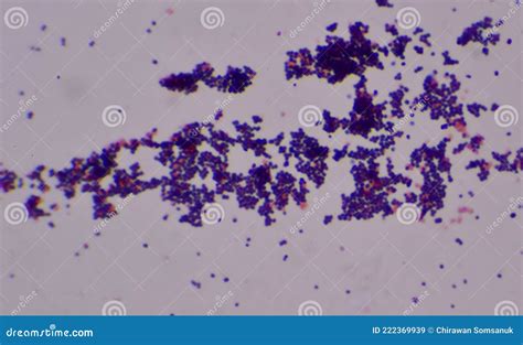 Hallazgo De Cocos Grampositivos Con Microscopio Imagen De Archivo