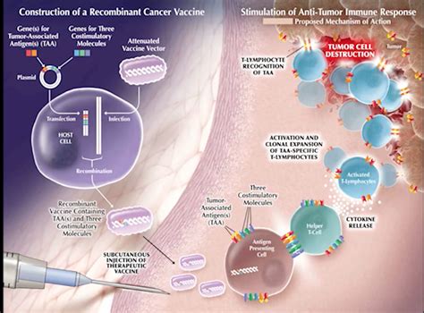 Immunotherapy For Prostate Cancer Grand Rounds In Urology