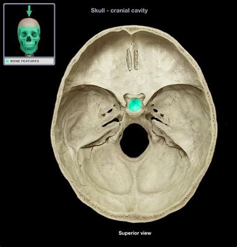 sella turcica - Google'da Ara | Axial skeleton, Skeletal system, Bones