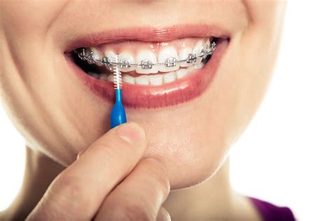 Common Oral Hygiene Mistakes When Wearing Braces Andros Orthodontics Tri Cities Orthodontics