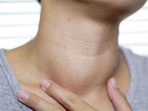 Thyroid Disease What Is Thyroid Disease