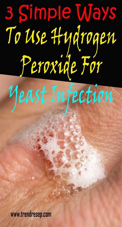 Yeast Infection Creates Indicators And Symptoms And Also Just How To