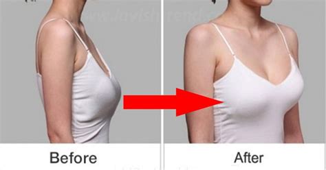 This Is How You Can Perk Up Your Breasts In Less Than A Week Remedios Caseros Remedios