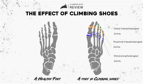 Climbers Feet And Toes The Terrifying Truth Climbing Shoe Review