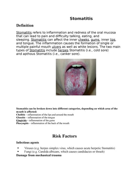 Stomatitis Stomatitis Definition Stomatitis Refers To Inflammation