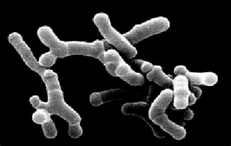 Bifidobacterium Características Reproducción Nutrición Beneficios