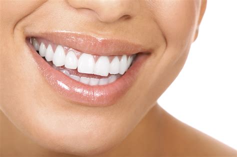 Why Choose Porcelain Veneers For The Perfect Smile Caffaratti Dental