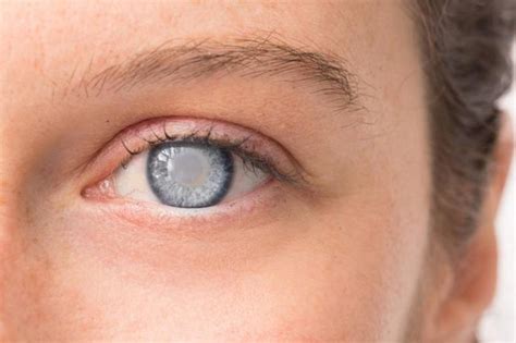 Most Common Eye Problems And Their Treatment