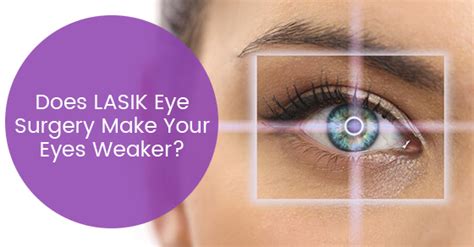 However, most lasik patients are not younger than their early 20's. Does LASIK Eye Surgery Make Your Eyes Weaker? | South ...